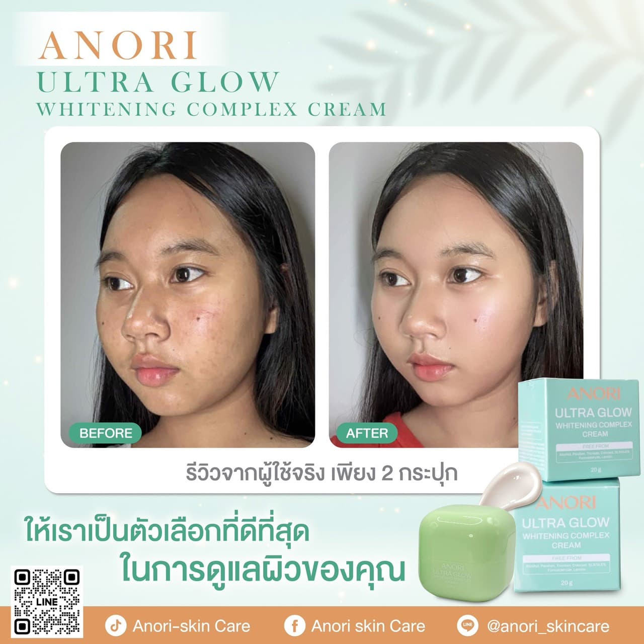 Anori UltraGlow Whitening Complex Cream - Review 1