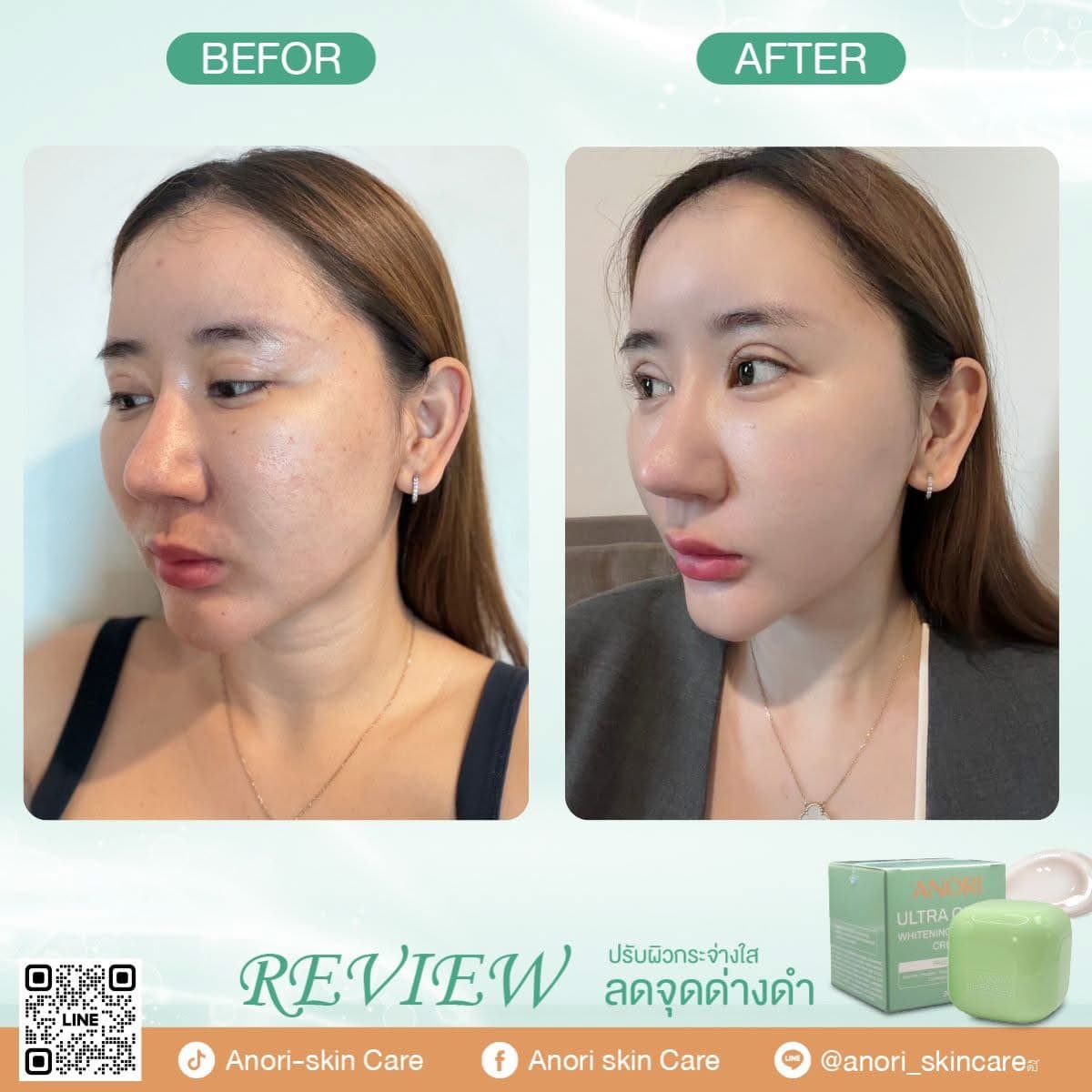 Anori UltraGlow Whitening Complex Cream - Review 2