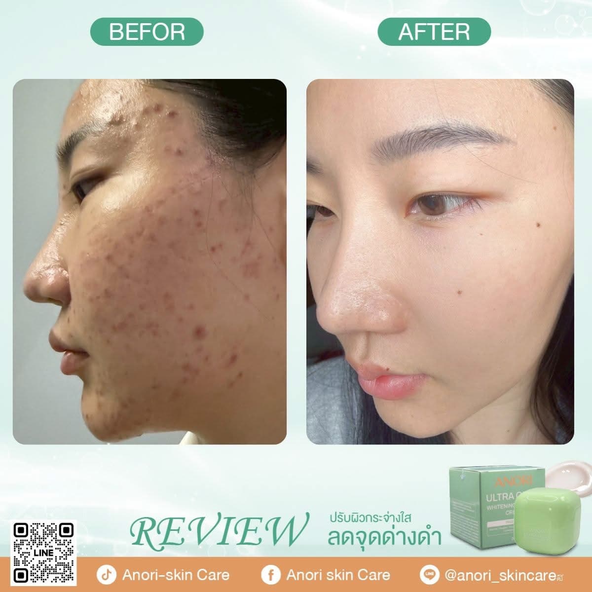 Anori UltraGlow Whitening Complex Cream - Review 3