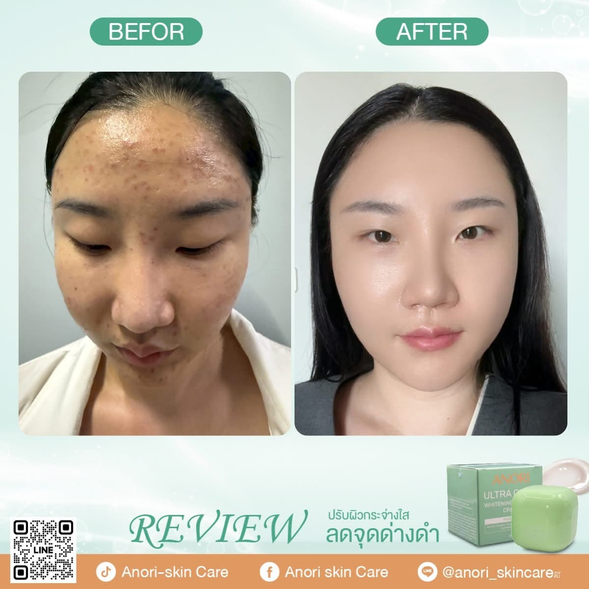 Anori UltraGlow Whitening Complex Cream - Clinic